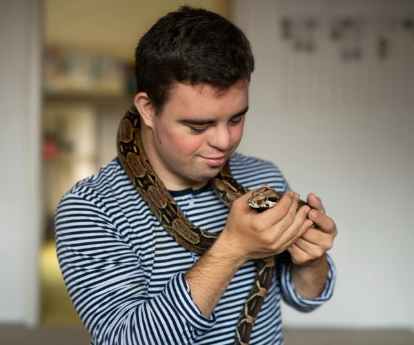 Person checking the health of a snake